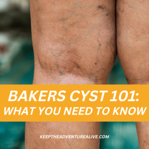 baker's cyst behind the knee