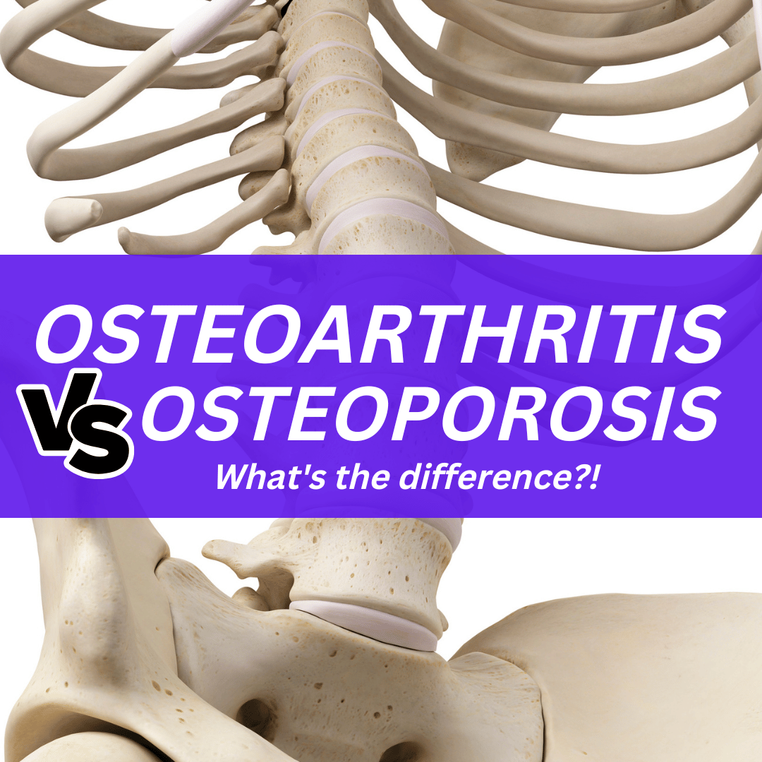 osteoarthritis vs osteoporosis