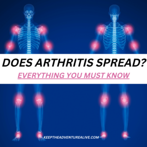 does osteoarthritis spread